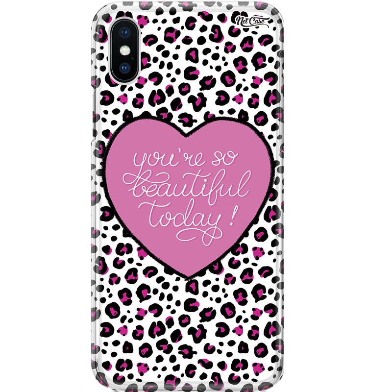 Capa Silicone NetCase Chapada Oncinha Coração You're So Beautiful Today!